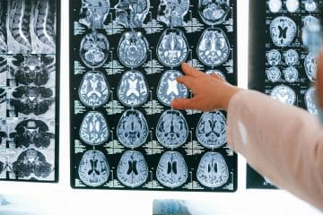 Kateri obrok dneva je najpomembnejši za zdravje možganov?