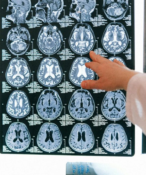 Kako ohraniti spomin in zbranost? To je preprost vsakodnevni trening za možgane