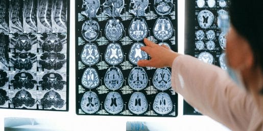 Kateri obrok dneva je najpomembnejši za zdravje možganov?