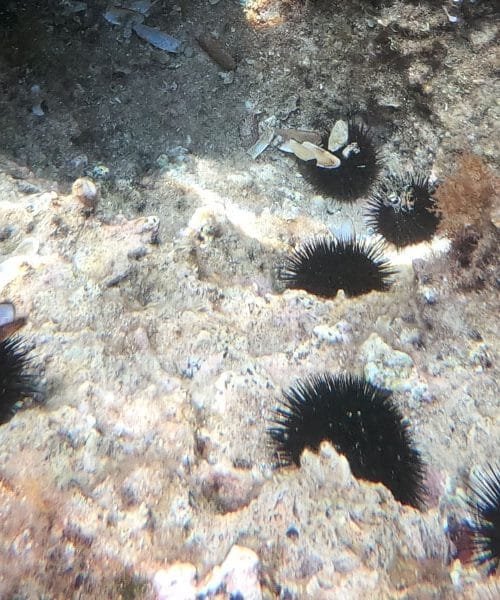 Kako najbolj enostavno odstraniti bodico morskega ježka iz podplata?