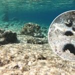 Prva pomoč, ubod na morskega ježka