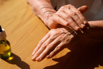 Pozimi se nam pogosteje lušči koža in domača rešitev, ki res pomaga