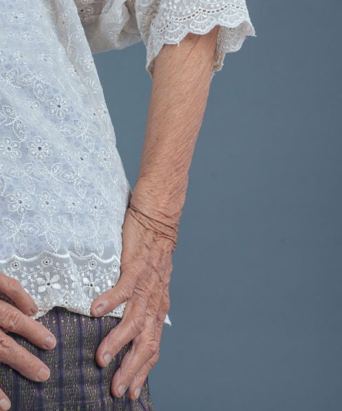 Bolečine v križu? Morda niso kriva leta, ampak ta napačna navada pri sedenju