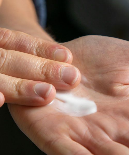 Razpokani členki in boleča suha koža: Rešitev, ki obnovi vaše roke med spanjem