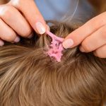 Žvečilni gumi v laseh