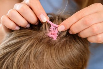 Kako iz las najbolj enostavno odstranite žvečilni gumi – brez striženja in panike